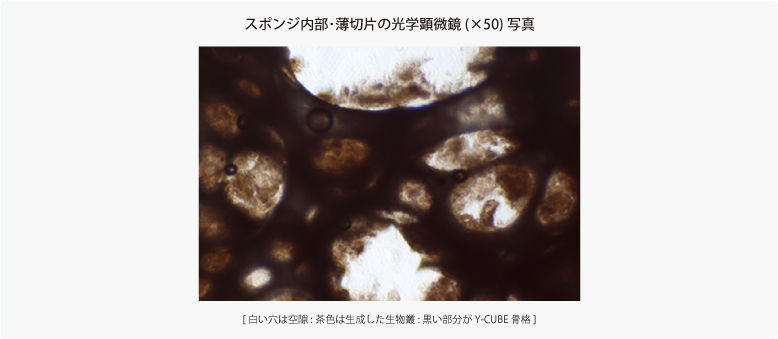 スポンジ内部・薄切片の光学顕微鏡(x50)写真